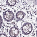 Immunohistochemical staining of human colon using Anti-ADH6 antibody HPA067946.