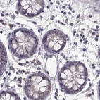 Immunohistochemical staining of human colon using Anti-ADH6 antibody HPA067946.