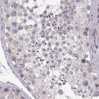 Immunohistochemical staining of human testis using Anti-ADH6 antibody HPA067946.