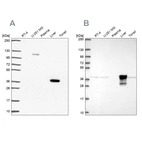 Western blot analysis using Anti-ADH6 antibody HPA067946 (A) shows similar pattern to independent antibody HPA069081 (B).