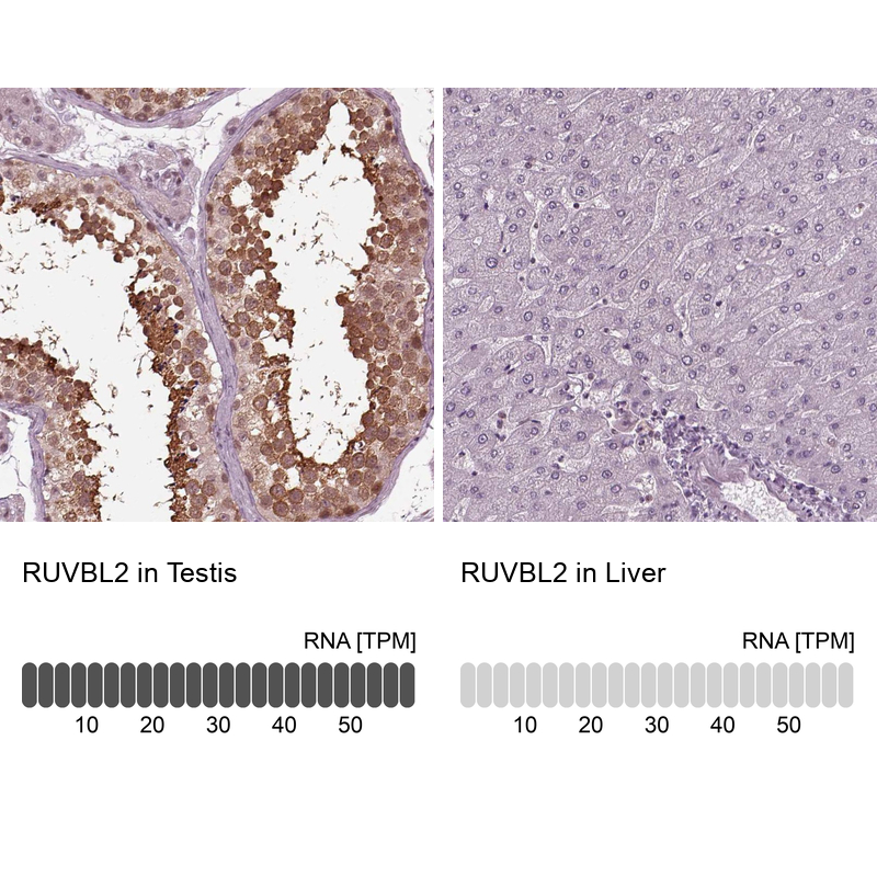 Anti-RUVBL2 Antibody