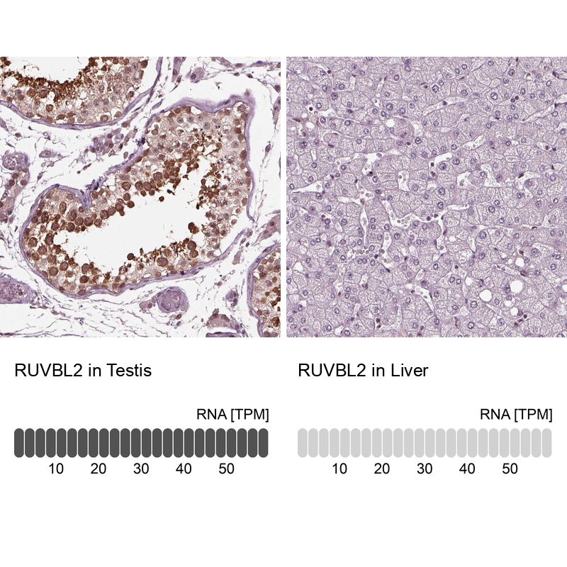 Anti-RUVBL2 Antibody