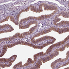 Immunohistochemical staining of human fallopian tube shows strong cytoplasmic positivity in glandular cells.