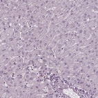 Anti-RUVBL2 Antibody
