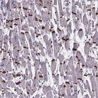 Anti-RD3L Antibody