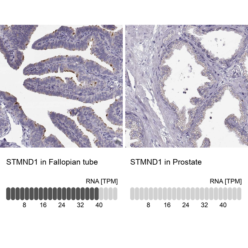 Anti-STMND1 Antibody