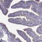 Immunohistochemical staining of human fallopian tube shows high expression.