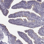 Immunohistochemical staining of human fallopian tube shows high expression.