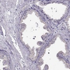 Immunohistochemical staining of human prostate shows low expression as expected.