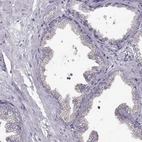 Immunohistochemical staining of human prostate shows low expression as expected.