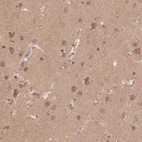 Anti-AP2B1 Antibody