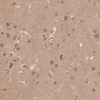 Anti-AP2B1 Antibody