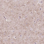 Anti-GPR37 Antibody