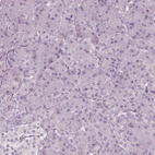 Immunohistochemical staining of human pancreas shows no positivity in exocrine glandular cells as expected.