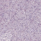 Immunohistochemical staining of human pancreas shows no positivity in exocrine glandular cells as expected.