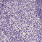Anti-GPR37 Antibody