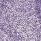 Immunohistochemical staining of human tonsil shows no positivity in germinal center cells as expected.