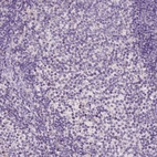 Immunohistochemical staining of human tonsil shows no positivity in germinal center cells as expected.
