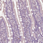 Immunohistochemical staining of human duodenum shows no positivity in glandular cells as expected.
