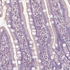Immunohistochemical staining of human duodenum shows no positivity in glandular cells as expected.