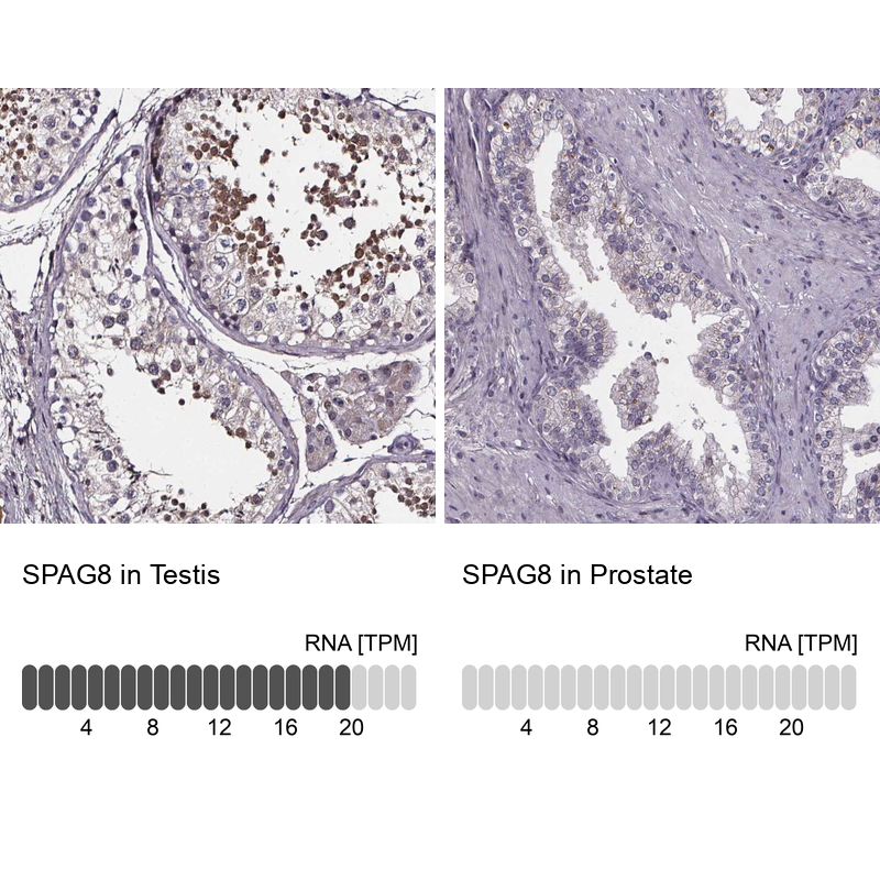 Anti-SPAG8 Antibody