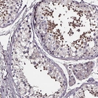 Immunohistochemical staining of human testis shows high expression.