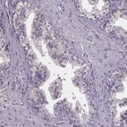 Anti-SPAG8 Antibody