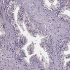Immunohistochemical staining of human prostate shows low expression as expected.
