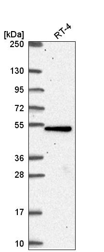 Anti-TBC1D24 Antibody