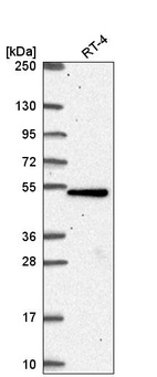 Anti-TBC1D24 Antibody