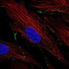 Immunofluorescent staining of human cell line BJ shows localization to plasma membrane & cell junctions.