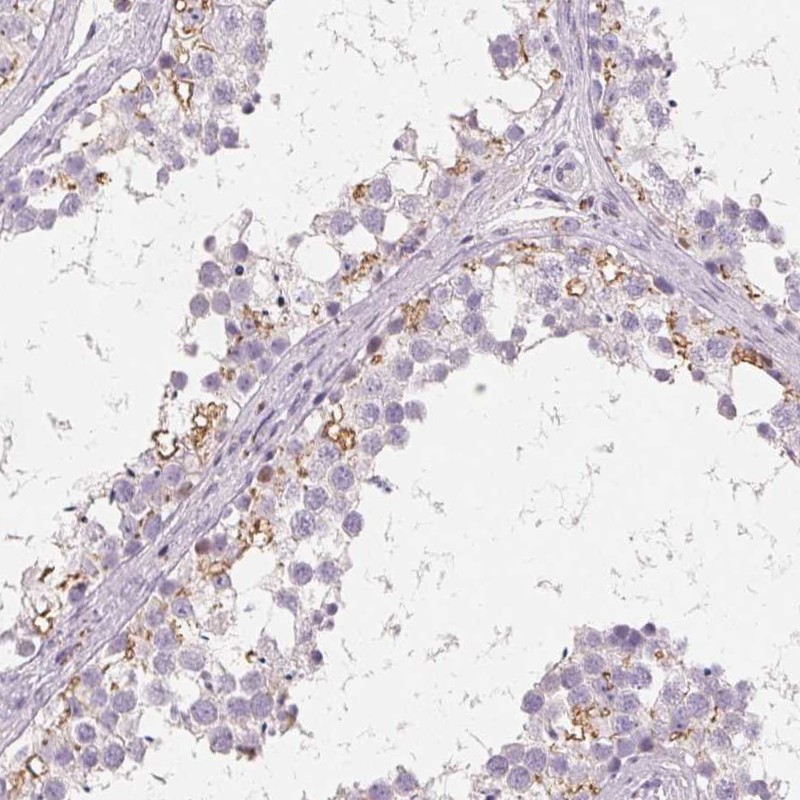 Anti-C19orf84 Antibody