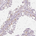 Anti-C19orf84 Antibody