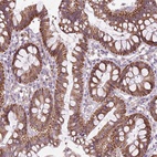 Anti-THEGL Antibody