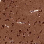 Anti-CYFIP1 Antibody