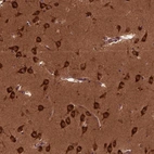 Anti-CYFIP1 Antibody