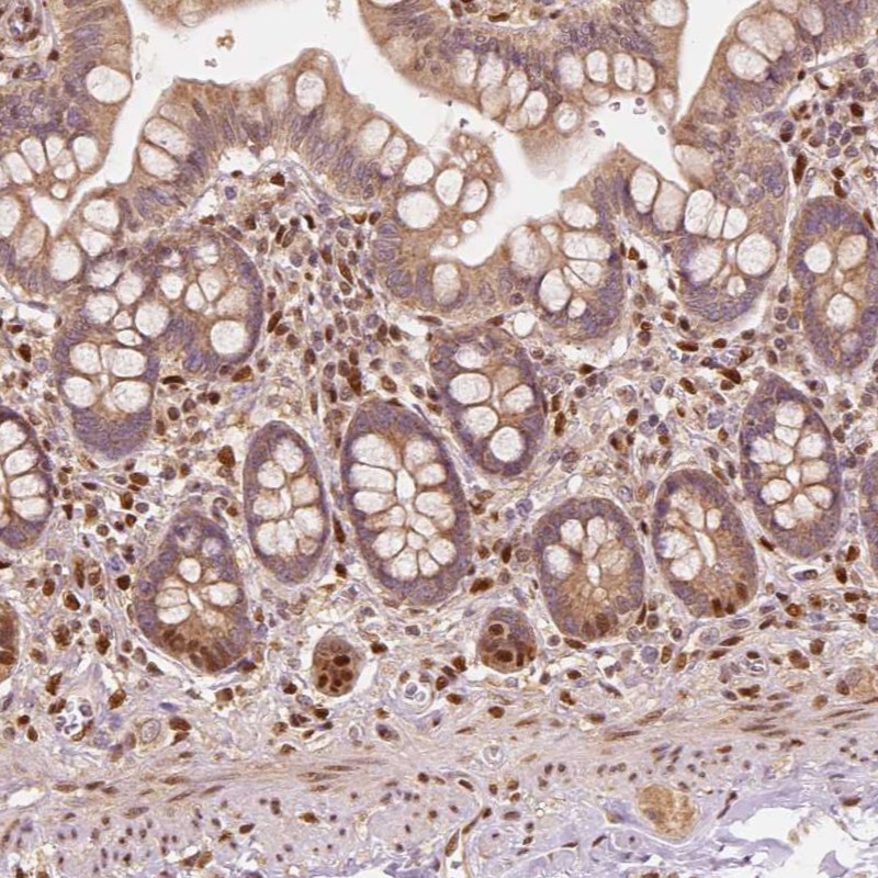 Anti-TBC1D17 Antibody