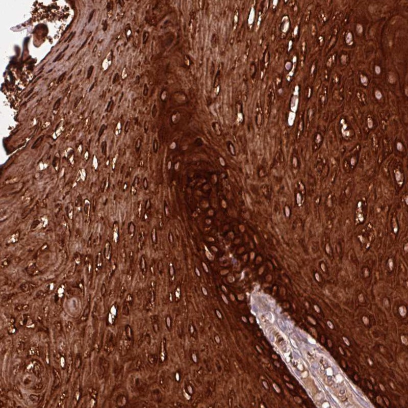 Anti-ZNF286B Antibody