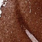 Anti-ZNF286B Antibody