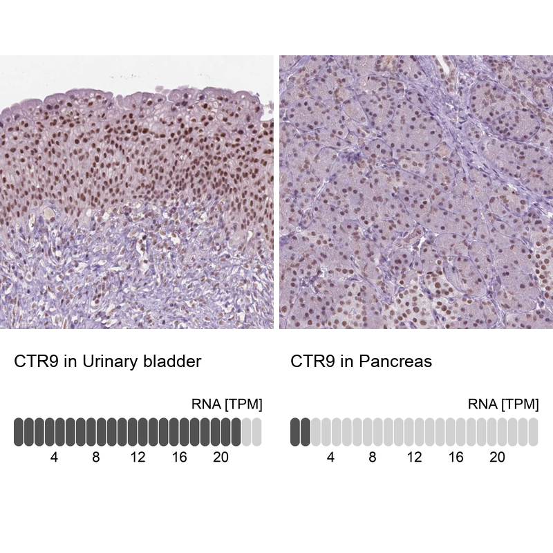 Anti-CTR9 Antibody