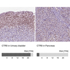 Anti-CTR9 Antibody