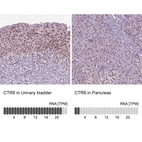 Anti-CTR9 Antibody