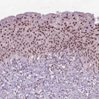 Immunohistochemical staining of human urinary bladder shows high expression.