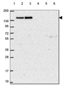 Lane 1: Marker [kDa] 250, 130, 95, 72, 55, 36, 28, 17, 10_br/_Lane 2: Human cell line RT-4_br/_Lane 3: Human cell line U-251 MG_br/_Lane 4: Human plasma_br/_Lane 5: Human Liver tissue_br/_Lane 6: Human Tonsil tissue