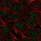 Immunofluorescent staining of human cell line RT4 shows localization to nucleoplasm.