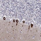 Anti-CACNA1A Antibody