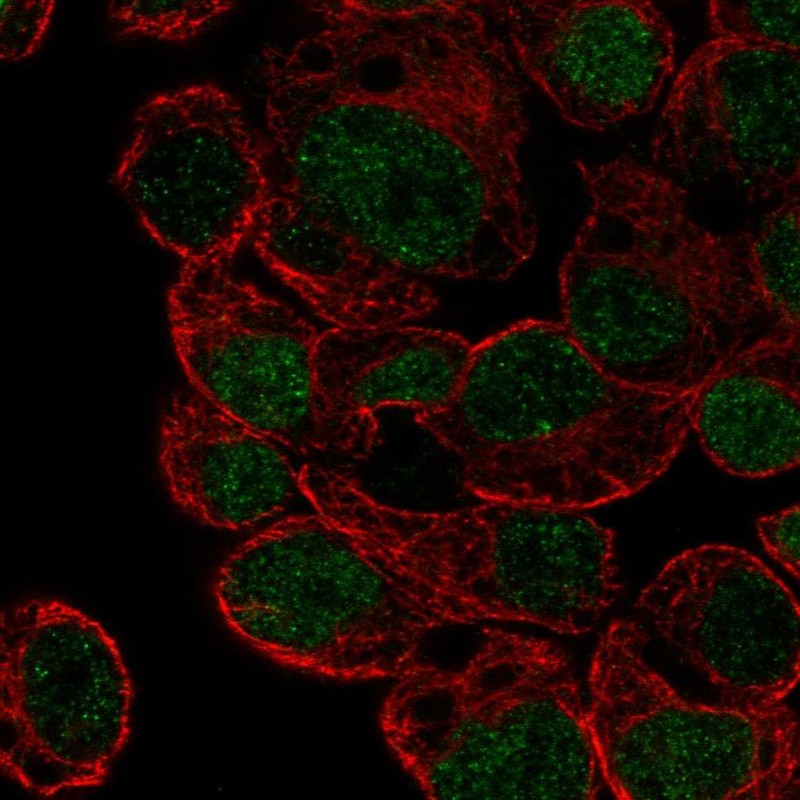 Anti-HLF Antibody