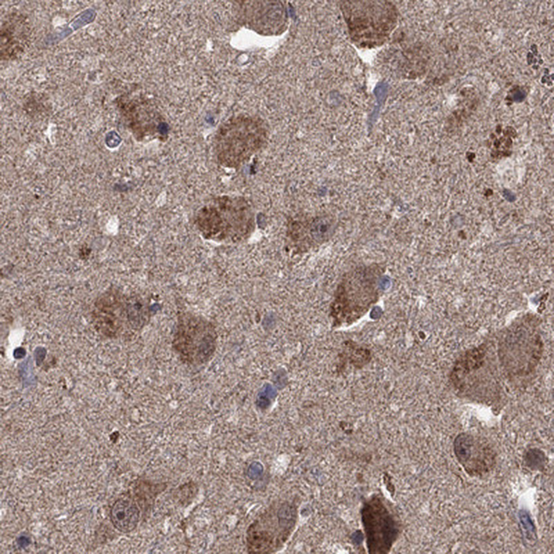 Anti-HTR6 Antibody