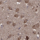 Anti-HTR6 Antibody
