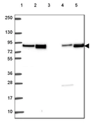 Lane 1: Marker [kDa] 250, 130, 95, 72, 55, 36, 28, 17, 10_br/_Lane 2: Human cell line RT-4_br/_Lane 3: Human cell line U-251 MG_br/_Lane 4: Human plasma_br/_Lane 5: Human Liver tissue